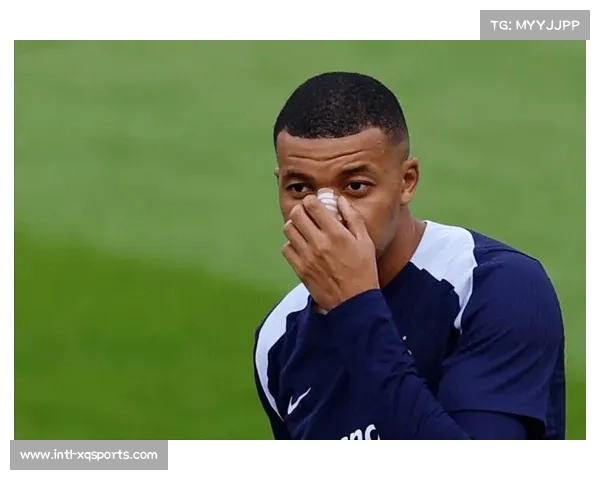 姆巴佩手指骨折带伤出战,皇马锋线依赖度成双刃剑 姆巴佩手指骨折带伤出战,皇马锋线依赖度成双刃剑